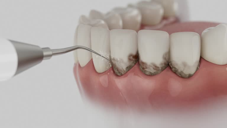 Trusted Tooth Extraction service in Pittsfield, IL - Dentist Open Now